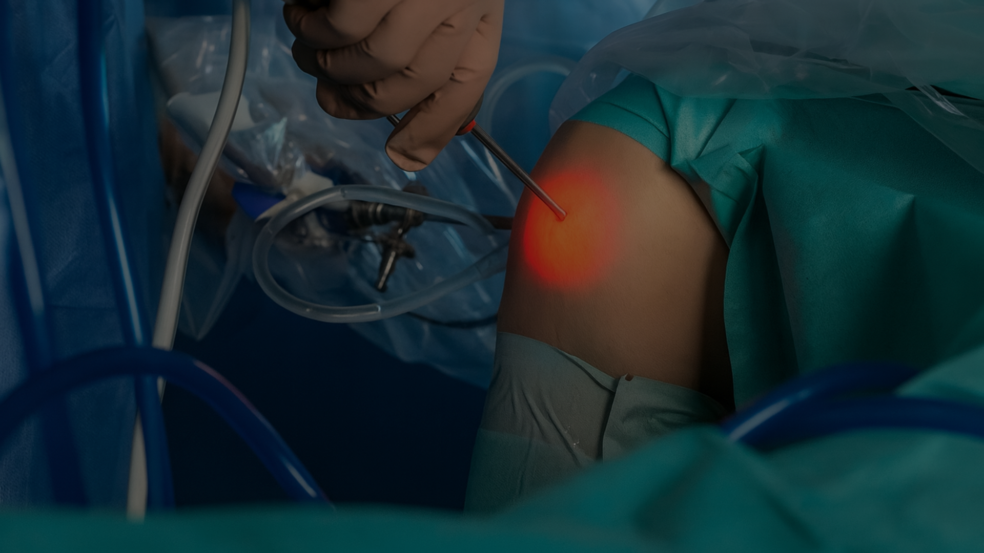 arthroscopie