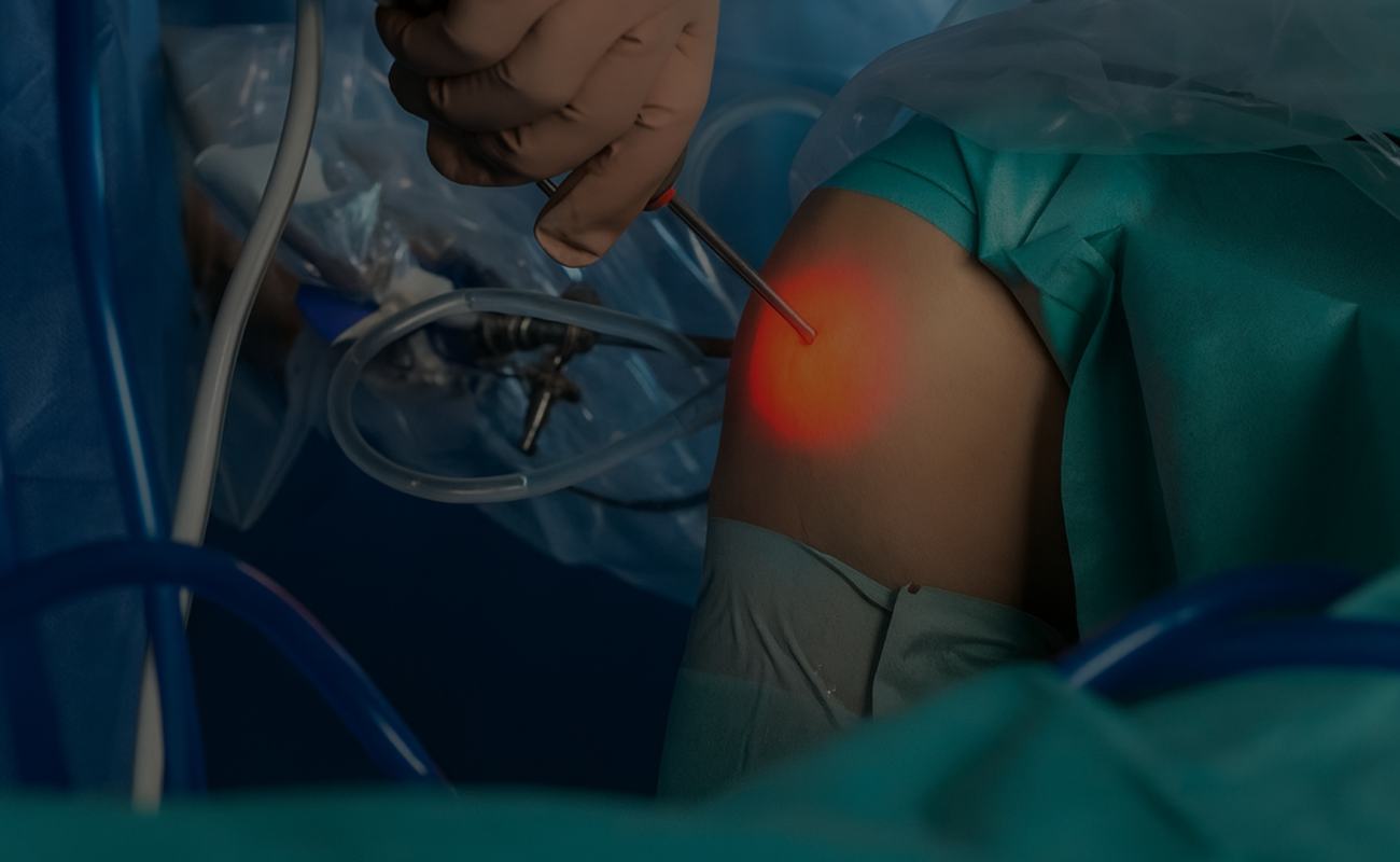 arthroscopie