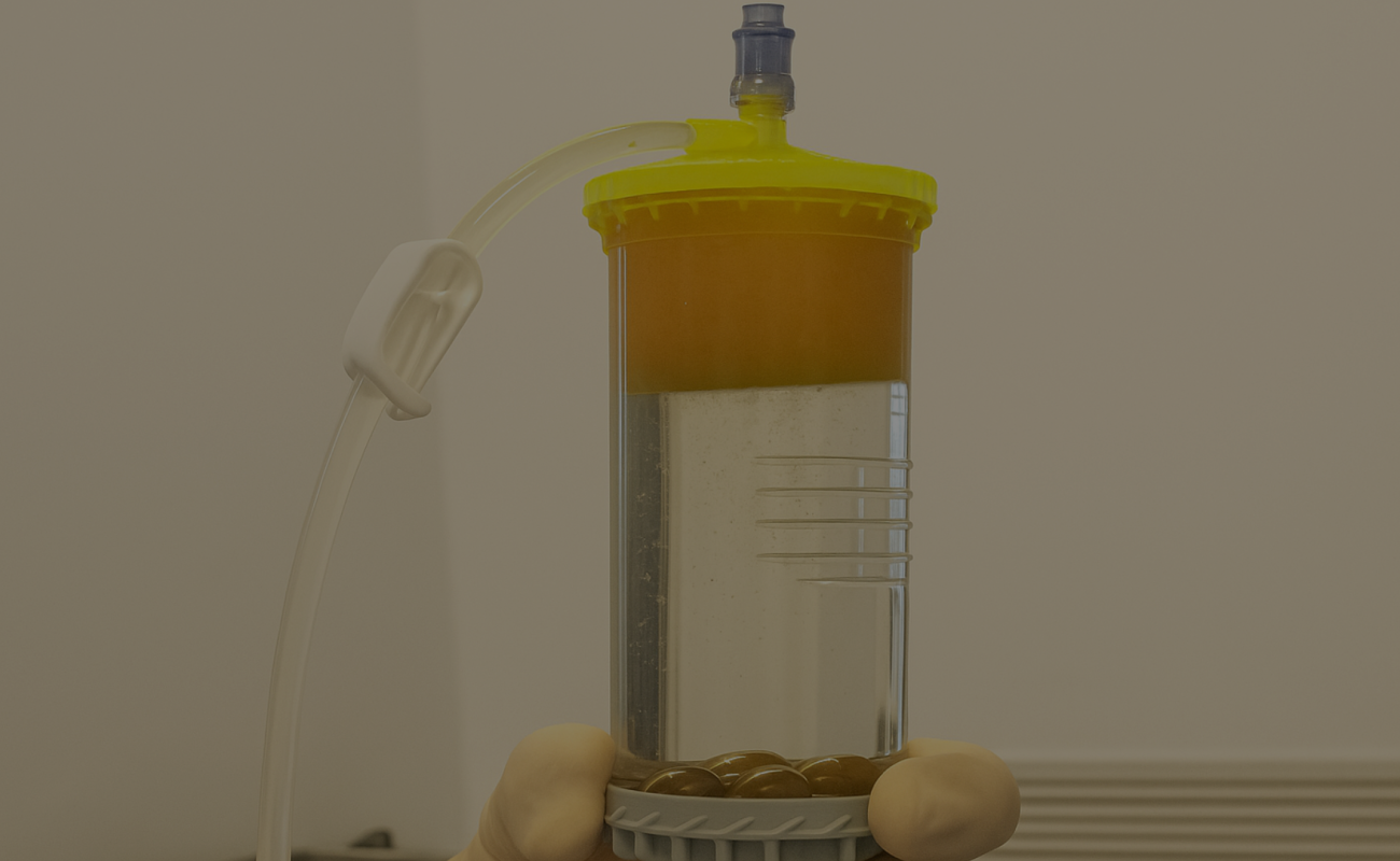 lipogems