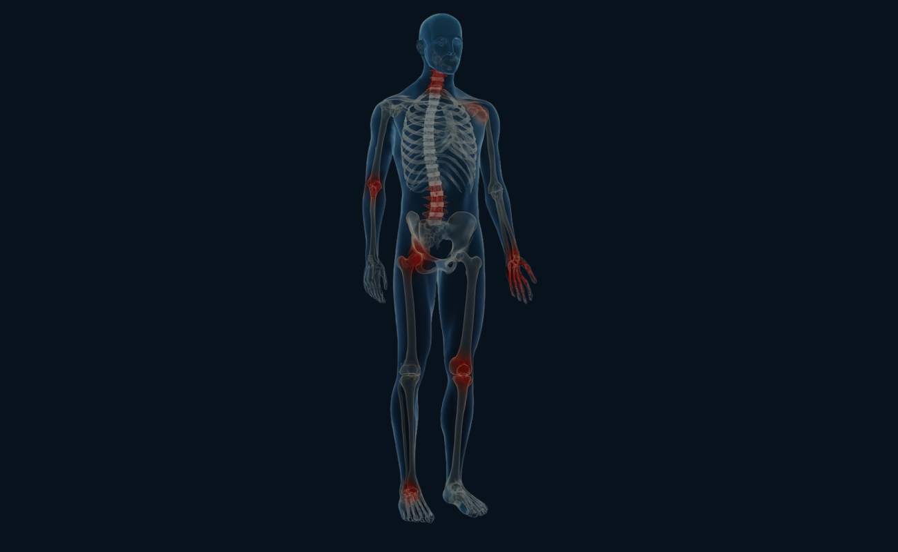 arthrose signes